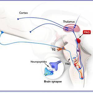 Migraine Prodrome Symptoms - 100% Natural Cures For Migraine Headaches