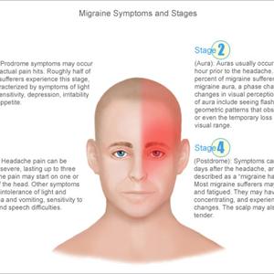 Migraine Botox - The Migraine Aura - Tricks From The Brain