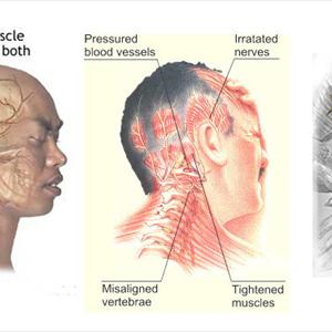 Osu Migraine Zapper - A Migraine Sufferer Can Be Warned By Various Symptoms